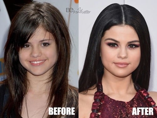 A picture of Selena Gomez before (left) and after (right).